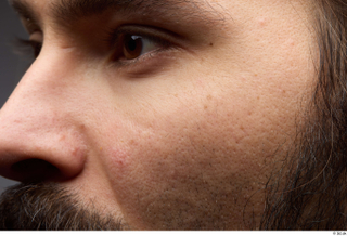HD Face Skin Turgen cheek eye face nose skin pores…